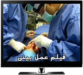 فیلم پربازدید عمل بینی دکتر حسنانی
